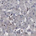 Anti-CDV3 Antibody