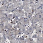 Immunohistochemical staining of human liver using Anti-CDV3 antibody HPA029761.