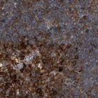 Immunohistochemical staining of human tonsil using Anti-CDV3 antibody HPA029761.