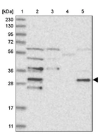 Lane 1: Marker [kDa] 230, 130, 95, 72, 56, 36, 28, 17, 11_br/_Lane 2: Human cell line RT-4_br/_Lane 3: Human cell line U-251MG sp_br/_Lane 4: Human plasma (IgG/HSA depleted)_br/_Lane 5: Human liver tissue
