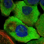 Immunofluorescent staining of human cell line A-431 shows localization to nucleoli, plasma membrane & cytosol.