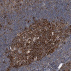 Immunohistochemical staining of human tonsil shows high expression.