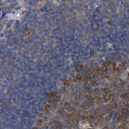 Immunohistochemical staining of human lymph node using Anti-CDV3 antibody HPA029762.