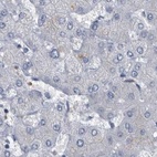 Immunohistochemical staining of human liver using Anti-CDV3 antibody HPA029762.