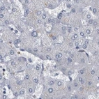 Immunohistochemical staining of human liver using Anti-CDV3 antibody HPA029762.