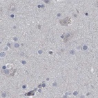Immunohistochemical staining of human cerebral cortex using Anti-CDV3 antibody HPA029762.
