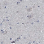 Immunohistochemical staining of human cerebral cortex using Anti-CDV3 antibody HPA029762.