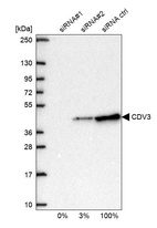 Western blot analysis in U2OS cells transfected with control siRNA, target specific siRNA probe #1 and #2, using Anti-CDV3 antibody. Remaining relative intensity is presented.