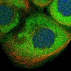 Immunofluorescent staining of human cell line A-431 shows localization to plasma membrane & cytosol.