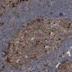 Immunohistochemical staining of human tonsil shows high expression.