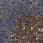 Immunohistochemical staining of human lymph node using Anti-CDV3 antibody HPA029763.