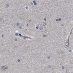 Immunohistochemical staining of human cerebral cortex using Anti-CDV3 antibody HPA029763.