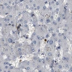 Immunohistochemical staining of human liver using Anti-CDV3 antibody HPA029763.