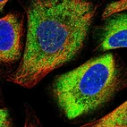Immunofluorescent staining of human cell line U-2 OS shows localization to cytosol.