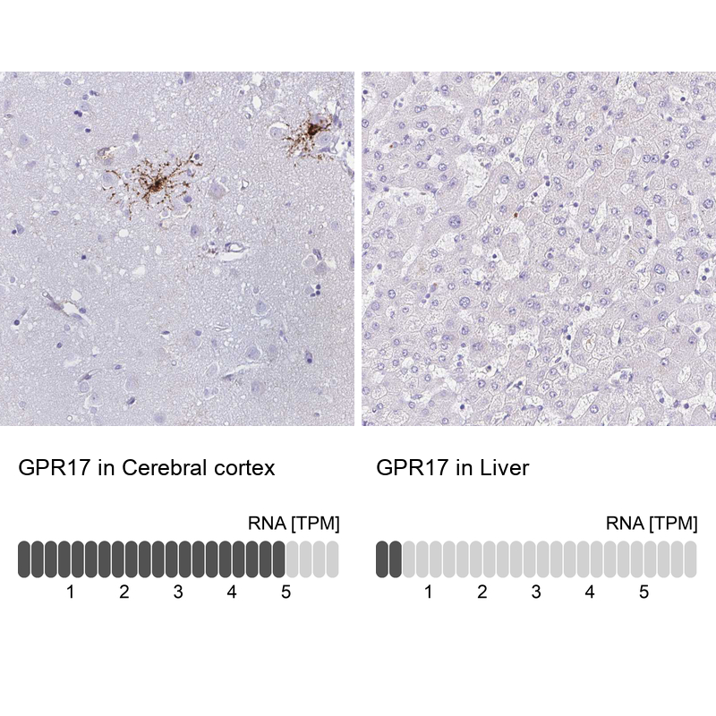 Anti-GPR17 Antibody