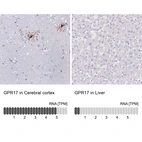 Anti-GPR17 Antibody
