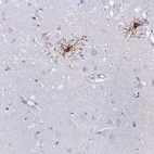 Immunohistochemical staining of human cerebral cortex shows moderate positivity in oligodendrocytes.