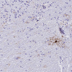Immunohistochemical staining of human cerebellum shows moderate positivity in oligodendrocytes.