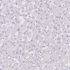 Immunohistochemical staining of human liver shows no positivity in hepatocytes as expected.