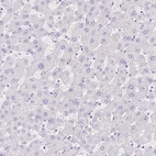 Immunohistochemical staining of human liver shows no positivity in hepatocytes as expected.