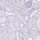 Immunohistochemical staining of human kidney shows no positivity in cells in tubules as expected.