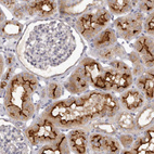 Immunohistochemical staining of human kidney shows strong membranous positivity in cells in tubules.