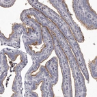 Immunohistochemical staining of human Fallopian tube shows strong positivity in apical membrane in glandular cells.