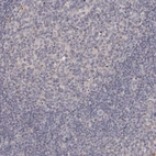 Immunohistochemical staining of human tonsil shows no positivity in lymphoid cells as expected.