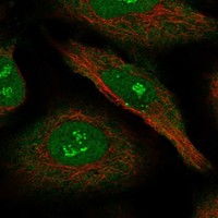 Anti-NRIP1 Antibody