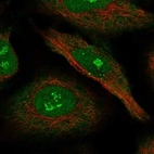 Anti-NRIP1 Antibody