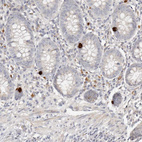 Immunohistochemical staining of human appendix shows moderate to strong cytoplasmic positivity in neuroendocrine cells.