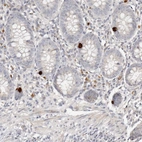Immunohistochemical staining of human appendix shows moderate to strong cytoplasmic positivity in neuroendocrine cells.