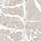Immunohistochemical staining of human skeletal muscle shows no positivity in myocytes as expected.