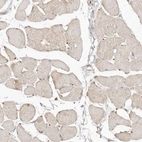 Immunohistochemical staining of human skeletal muscle shows no positivity in myocytes as expected.