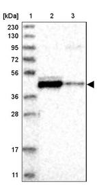 Lane 1: Marker [kDa] 230, 130, 95, 72, 56, 36, 28, 17, 11_br/_Lane 2: Human cell line RT-4_br/_Lane 3: Human cell line U-251MG sp