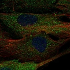 Immunofluorescent staining of human cell line BJ shows localization to cytosol.