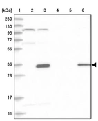 Lane 1: Marker [kDa] 230, 130, 95, 72, 56, 36, 28, 17, 11_br/_Lane 2: Human cell line RT-4_br/_Lane 3: Human cell line U-251MG sp_br/_Lane 4: Human plasma (IgG/HSA depleted)_br/_Lane 5: Human liver tissue_br/_Lane 6: Human tonsil tissue