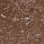 Immunohistochemical staining of human pancreas shows strong cytoplasmic positivity in glandular cells.