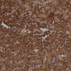 Anti-DARS Antibody