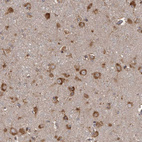 Anti-DARS Antibody