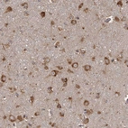 Immunohistochemical staining of human cerebral cortex shows strong cytoplasmic positivity in neuronal cells.