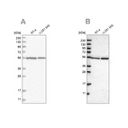 Anti-DARS Antibody