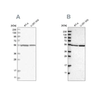 Western blot analysis using Anti-DARS antibody HPA029804 (A) shows similar pattern to independent antibody HPA020451 (B).