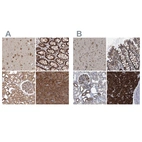 Anti-DARS Antibody