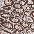 Immunohistochemical staining of human gastrointestinal shows strong cytoplasmic positivity in glandular cells.