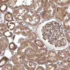 Immunohistochemical staining of human kidney shows strong cytoplasmic positivity in cells in tubules and cells in glomeruli.