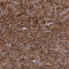 Immunohistochemical staining of human pancreas shows strong cytoplasmic positivity in glandular cells.