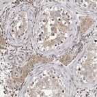 Immunohistochemical staining of human testis shows moderate cytoplasmic positivity in Leydig cells.