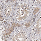 Anti-GADD45B Antibody