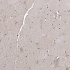 Immunohistochemical staining of human skeletal muscle shows weak positivity in a subset of myocytes.